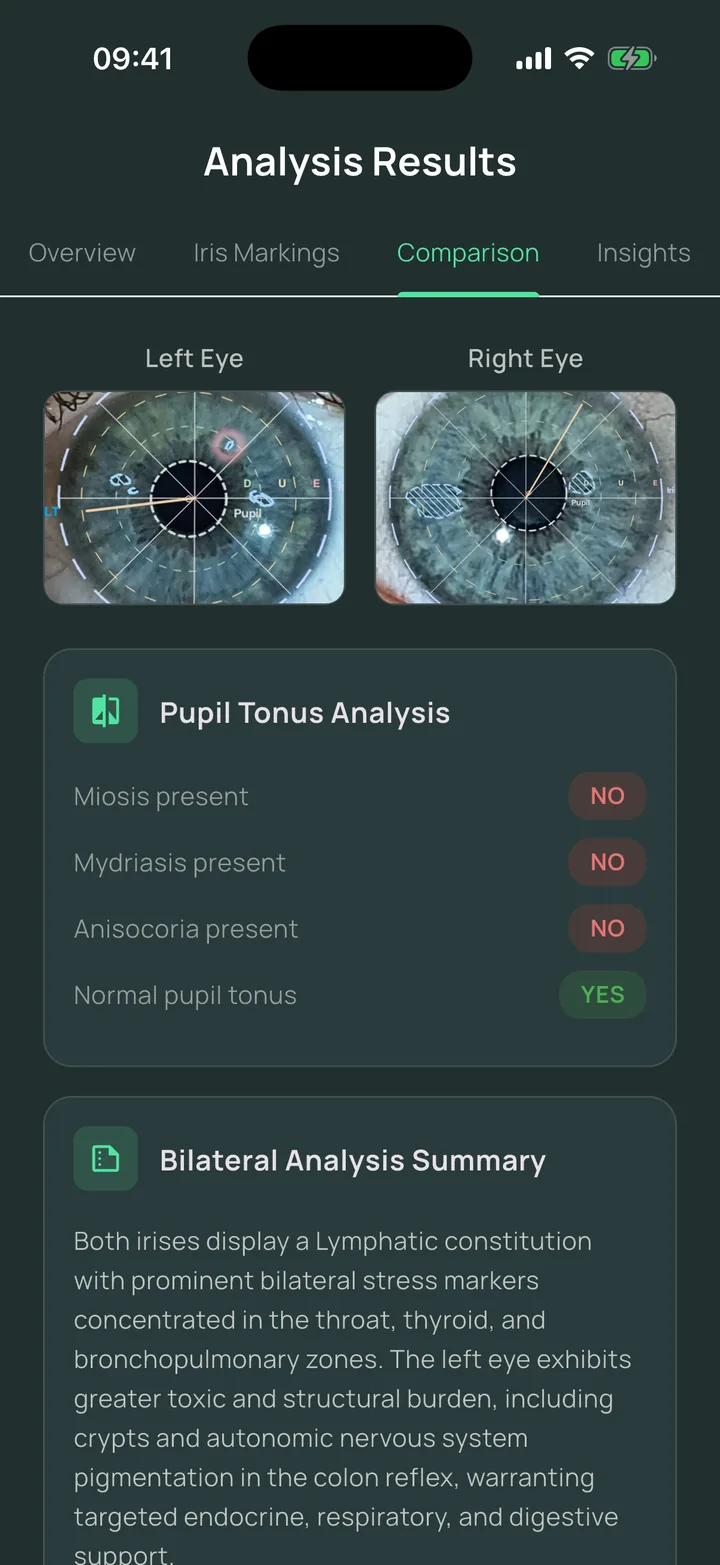 The Comparison screen of an Eyeagnosis report