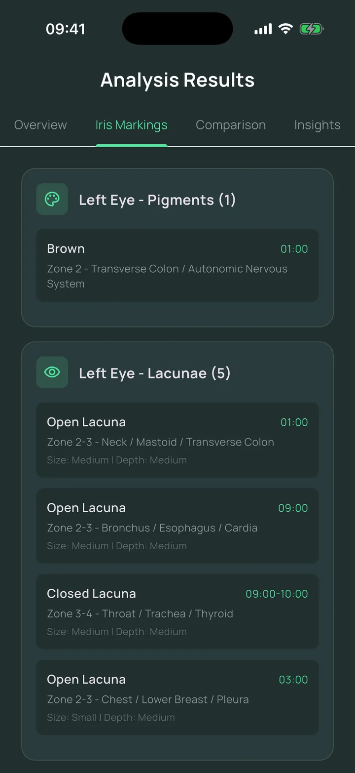 The Iris Markings screen of an Eyeagnosis report
